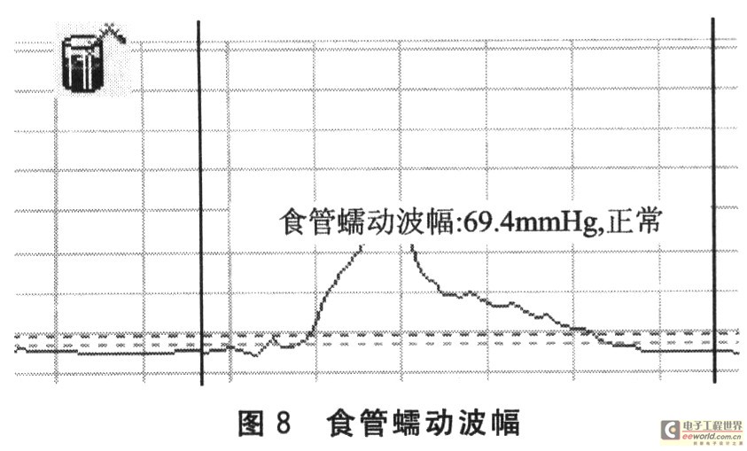 食管蠕動波幅