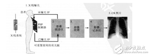 CR成像系統(tǒng)的構(gòu)造與成像原理分析