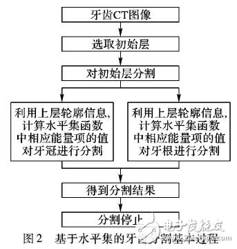 基于水平集的牙齒CT圖像分割技術(shù)