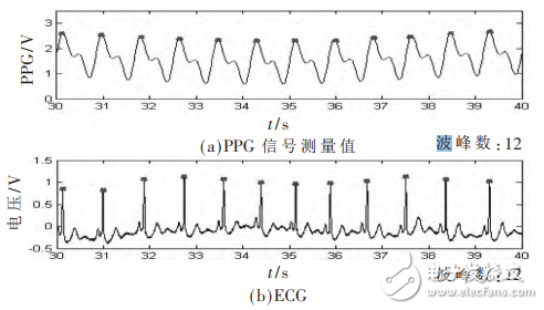 一種基于STM32和PPG技術(shù)的腕戴式心率計(jì)設(shè)計(jì)