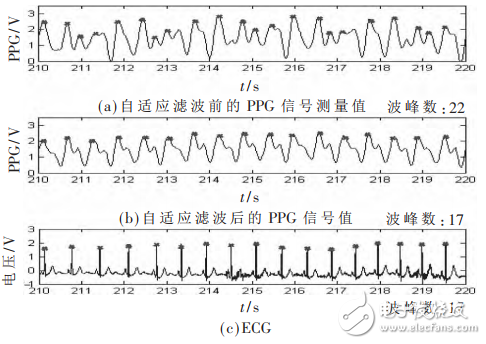 一種基于STM32和PPG技術(shù)的腕戴式心率計(jì)設(shè)計(jì)