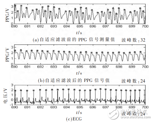 一種基于STM32和PPG技術(shù)的腕戴式心率計(jì)設(shè)計(jì)