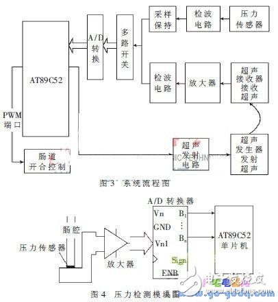 詳解智能人工肛門設(shè)計(jì)