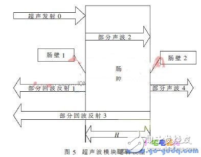 詳解智能人工肛門設(shè)計(jì)