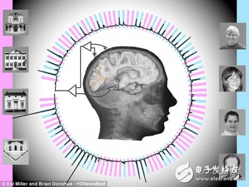 腦電波技術(shù)再上一層樓，讀心準(zhǔn)確率高達(dá)95%